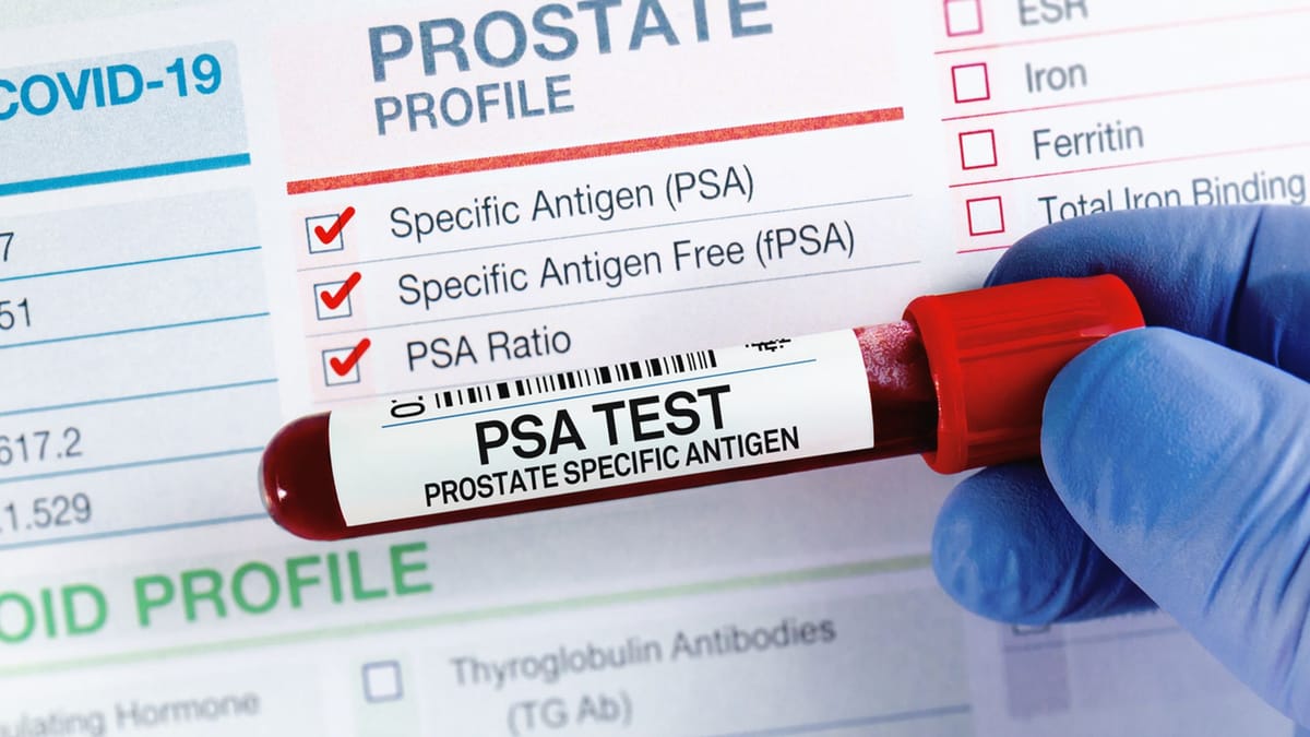 Over 68,000 UK men receive new prostate cancer diagnoses each year, charity warns of myths